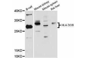 Image no. 1 for anti-Major Histocompatibility Complex, Class II, DO beta (HLA-DOB) antibody (ABIN6290471)