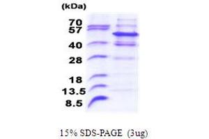 Image no. 1 for Pellino Homolog 2 (Drosophila) (PELI2) (AA 1-420) protein (His tag) (ABIN5853851)