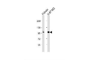 Image no. 3 for anti-Anoctamin 5 (ANO5) (AA 792-819), (C-Term) antibody (ABIN652521)