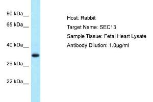 Image no. 1 for anti-SEC13 Homolog (SEC13) (C-Term) antibody (ABIN2789291)