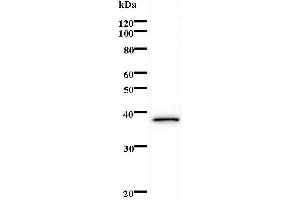 Image no. 2 for anti-DNA Repair Protein Complementing XP-B Cells (ERCC3) antibody (ABIN931186)