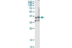 Image no. 1 for anti-Elastin Microfibril Interfacer 1 (EMILIN1) (AA 1-347) antibody (ABIN524528)