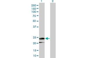 Image no. 1 for anti-Interferon, alpha 14 (IFNa14) (AA 1-189) antibody (ABIN516903)
