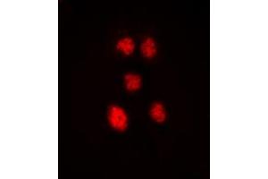 Image no. 2 for anti-Zinc Finger Protein 148 (ZNF148) (N-Term) antibody (ABIN2707788)