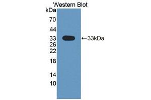 Image no. 1 for anti-Dual serine/threonine and tyrosine Protein Kinase (DSTYK) (AA 650-904) antibody (ABIN1867644)