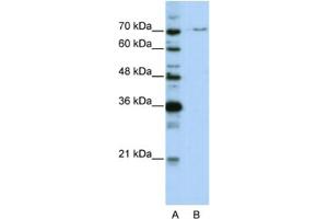 Image no. 1 for anti-PRP3 Pre-mRNA Processing Factor 3 Homolog (PRPF3) antibody (ABIN2462173)