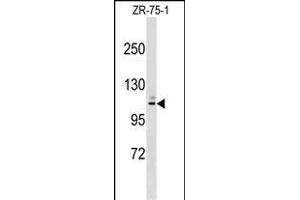 RCH10 Antibody (Center) (ABIN1538179 and ABIN2849108) western blot analysis in ZR-75-1 cell line lysates (35 μg/lane).