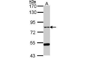 Image no. 2 for anti-ArfGAP with GTPase Domain, Ankyrin Repeat and PH Domain 1 (AGAP1) (C-Term) antibody (ABIN2856309)