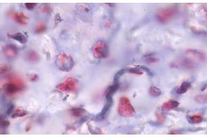 Image no. 1 for anti-Parathyroid Hormone 1 Receptor (PTH1R) (Internal Region) antibody (ABIN1049267)