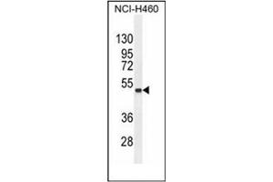 Image no. 1 for anti-Fibronectin Type III Domain Containing 8 (FNDC8) (AA 211-240), (Middle Region) antibody (ABIN952348)