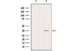Image no. 1 for anti-Fructosamine 3 Kinase (FN3K) (Internal Region) antibody (ABIN6257182)