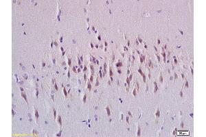 Image no. 1 for anti-RAB24, Member RAS Oncogene Family (RAB24) (AA 1-100) antibody (ABIN750373)