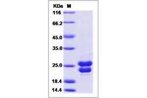 Image no. 1 for RAB2A, Member RAS Oncogene Family (RAB2A) (AA 1-212) protein (His tag) (ABIN2008759)