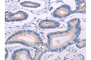 Tektin 4 antibody