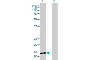 Image no. 1 for anti-Phospholipase A2, Group IIE (PLA2G2E) (AA 1-142) antibody (ABIN526257)
