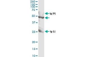 Immunoprecipitation of TALDO1 transfected lysate using anti-TALDO1 MaxPab rabbit polyclonal antibody and Protein A Magnetic Bead , and immunoblotted with TALDO1 MaxPab rabbit polyclonal antibody (D01) .