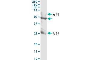 Image no. 3 for anti-Transaldolase 1 (TALDO1) (AA 1-337) antibody (ABIN948523)