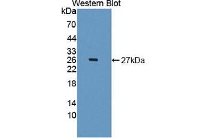 Image no. 1 for anti-Interleukin 1 Receptor Accessory Protein-Like 2 (IL1RAPL2) (AA 161-330) antibody (ABIN1868611)