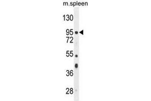 Image no. 1 for anti-NOP2/Sun Domain Family, Member 2 (NSUN2) (AA 426-455), (Middle Region) antibody (ABIN953759)