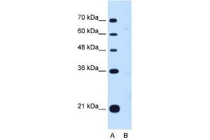 Image no. 1 for anti-Downstream Neighbor of SON (DONSON) (Middle Region) antibody (ABIN630570)