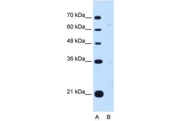 anti-Downstream Neighbor of SON (DONSON) (Middle Region) antibody