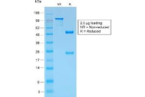 Image no. 1 for anti-Premelanosome Protein (PMEL) antibody (ABIN6940592)
