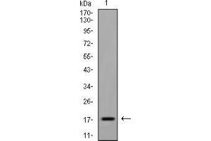 Image no. 4 for anti-Eukaryotic Translation Initiation Factor 5A (EIF5A) (AA 1-154) antibody (ABIN5542611)