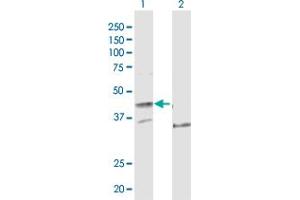Image no. 1 for anti-Polymerase (DNA Directed), Epsilon, Catalytic Subunit (POLE) (AA 1-370) antibody (ABIN948278)