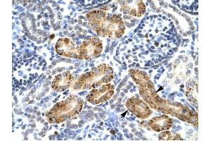 Image no. 1 for anti-Purinergic Receptor P2X, Ligand Gated Ion Channel 2 (P2RX2) (Middle Region) antibody (ABIN630093)