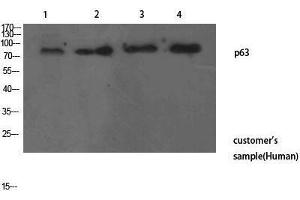 Image no. 1 for anti-T-Complex 1 (TCP1) (N-Term) antibody (ABIN3187722)