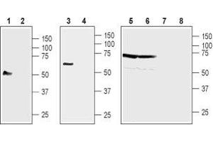 anti-NIPA-Like Domain Containing 4 (NIPAL4) (2nd Extracellular Loop), (AA 242-256) antibody