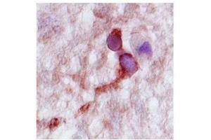 Image no. 1 for anti-Complexin 2 (CPLX2) (N-Term) antibody (ABIN633073)