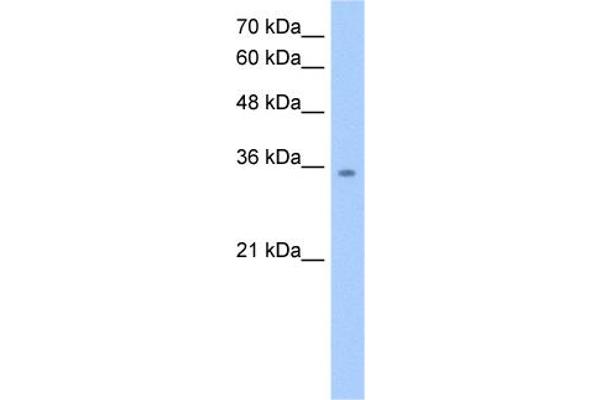 anti-Malate Dehydrogenase 2, NAD (Mitochondrial) (MDH2) (C-Term) antibody