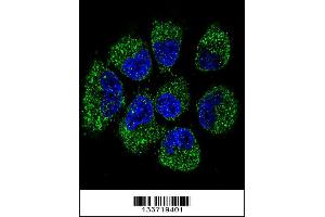 Image no. 2 for anti-Tumor Necrosis Factor Receptor Superfamily, Member 11b (TNFRSF11B) (Center) antibody (ABIN2497108)