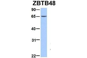 Image no. 4 for anti-Ets Variant 5 (ETV5) (N-Term) antibody (ABIN2780594)