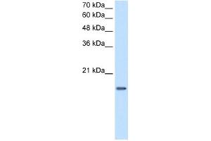 Image no. 3 for anti-Deoxyuridine Triphosphatase (DUT) (C-Term) antibody (ABIN2782436)
