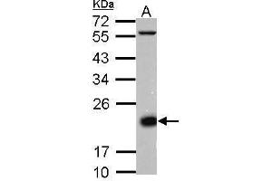 WB Image Sample (30 ug of whole cell lysate) A: Jurkat membrane 12% SDS PAGE antibody diluted at 1:10000