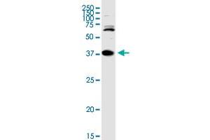 Image no. 7 for anti-three Prime Repair Exonuclease 1 (TREX1) (AA 1-369) antibody (ABIN524703)