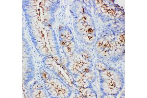 Image no. 2 for anti-Carcinoembryonic Antigen-Related Cell Adhesion Molecule 1 (Biliary Glycoprotein) (CEACAM1) antibody (ABIN3043635)