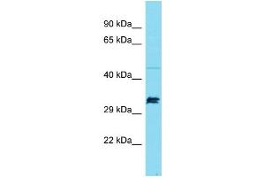 Image no. 1 for anti-Suppressor of Ty 7 Like (SUPT7L) (Middle Region) antibody (ABIN2790711)
