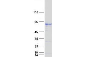 Image no. 1 for serum Amyloid A-Like 1 (SAAL1) protein (Myc-DYKDDDDK Tag) (ABIN2731345)