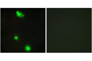 Image no. 2 for anti-serine/arginine-Rich Splicing Factor 3 (SRSF3) (AA 111-160) antibody (ABIN1533812)