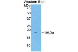Image no. 1 for anti-Coagulation Factor II (thrombin) (F2) (AA 44-200) antibody (ABIN1077942)