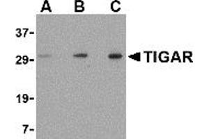 Image no. 1 for anti-TP53 induced glycolysis regulatory phosphatase (TIGAR) (Middle Region 1) antibody (ABIN1031193)