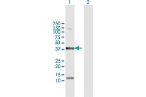 Image no. 4 for anti-serine/threonine/tyrosine Kinase 1 (STYK1) (AA 1-422) antibody (ABIN950094)
