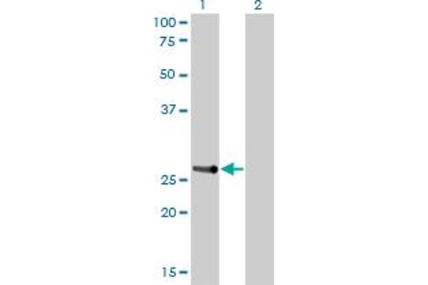 HOXA7 antibody  (AA 58-112)
