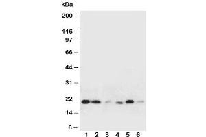 Image no. 4 for anti-Heat Shock 27kDa Protein 2 (HSPB2) (Middle Region) antibody (ABIN3031147)