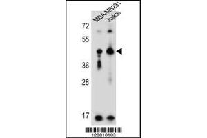 Image no. 1 for anti-Killer Cell Immunoglobulin-Like Receptor, Two Domains, Long Cytoplasmic Tail, 2 (KIR2DL2) (AA 263-291), (C-Term) antibody (ABIN5533883)