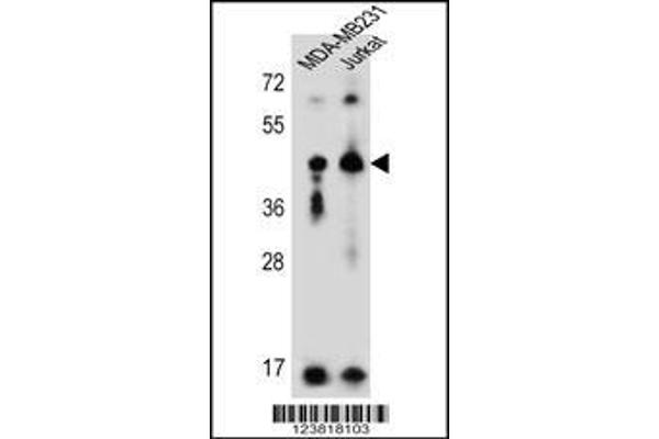 anti-Killer Cell Immunoglobulin-Like Receptor, Two Domains, Long Cytoplasmic Tail, 2 (KIR2DL2) (AA 263-291), (C-Term) antibody