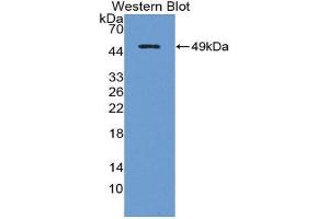 Image no. 1 for anti-Interleukin 18 Receptor Accessory Protein (IL18RAP) (AA 310-451) antibody (ABIN1862748)